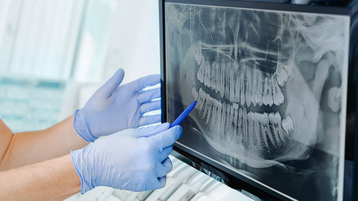 Digitales Röntgen | Zahnarzt Dr. Soldierer